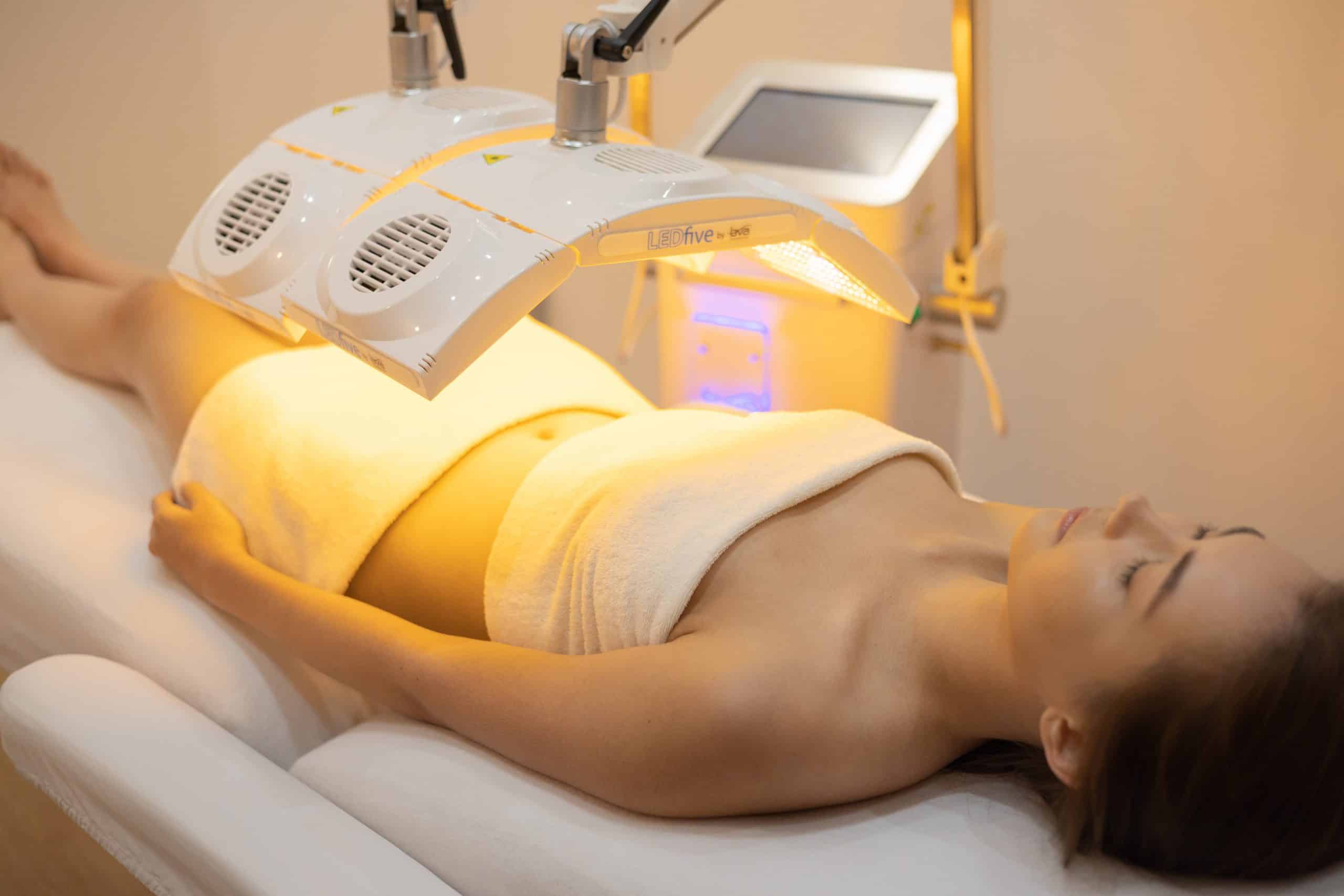 Intensive Stretch Mark Removal