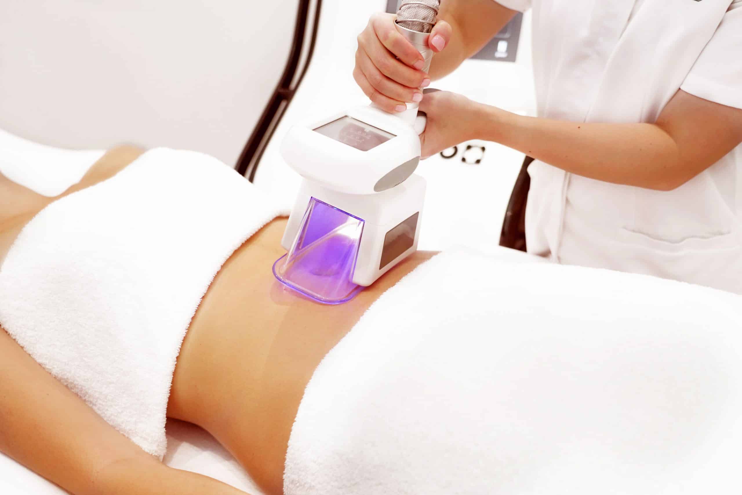 EstheCryo